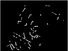 Steuerpedal - Hebeln